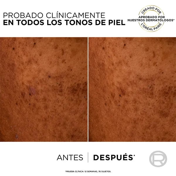 Bright Reveal Niacinamid Feuchtigkeitsfluid gegen Flecken SPF50+ 50 ml von L'Oreal Paris