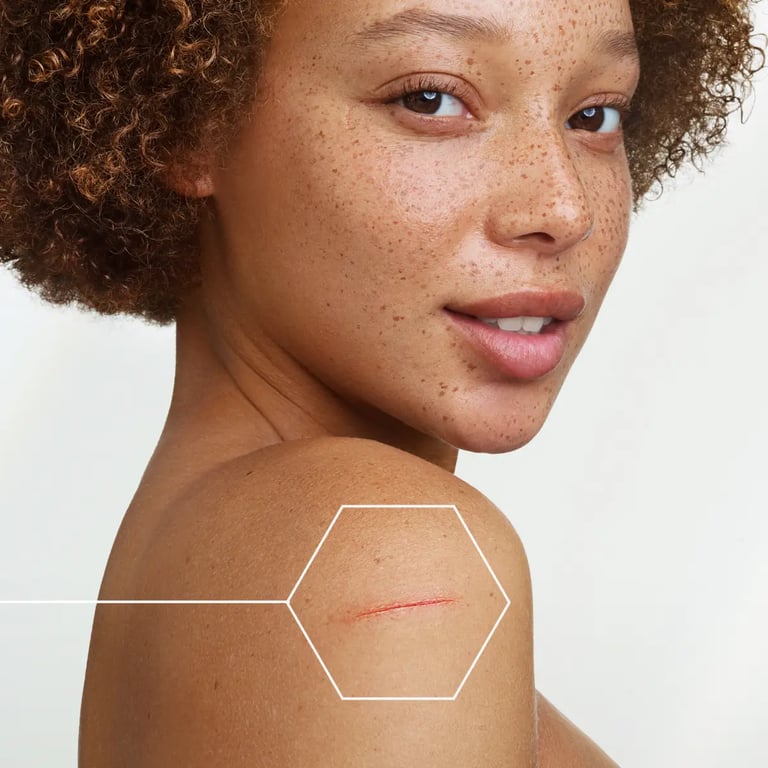 Epitheliale HA+ Ultra Repair Creme SPF50+ - imagen 2 de 4