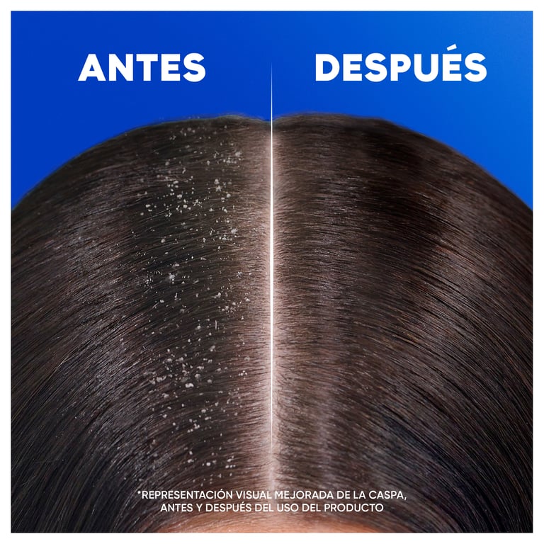 H&S Shampooing Antipelliculaire Nourrit Soigne 330 ml de Head & Shoulders