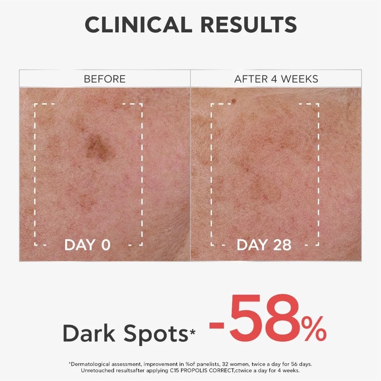 C15 Propolis Correct Serum - imagen 16 de 18