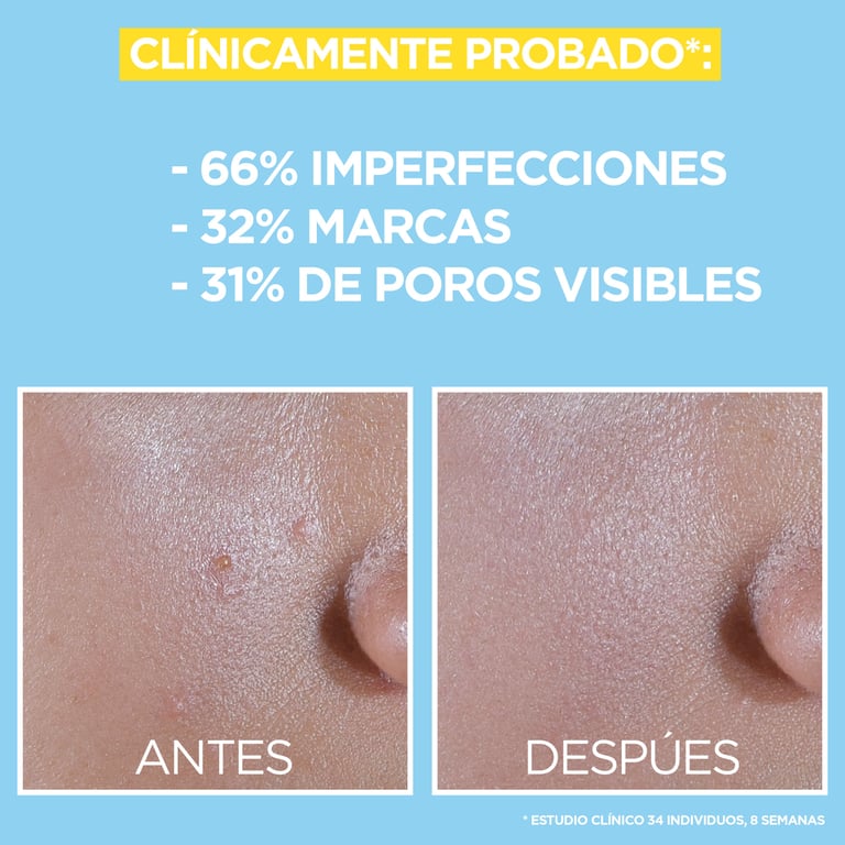 Pure Active Fluide Anti-imperfections BHA + Niacinamide SPF50+ 40 ml de Garnier