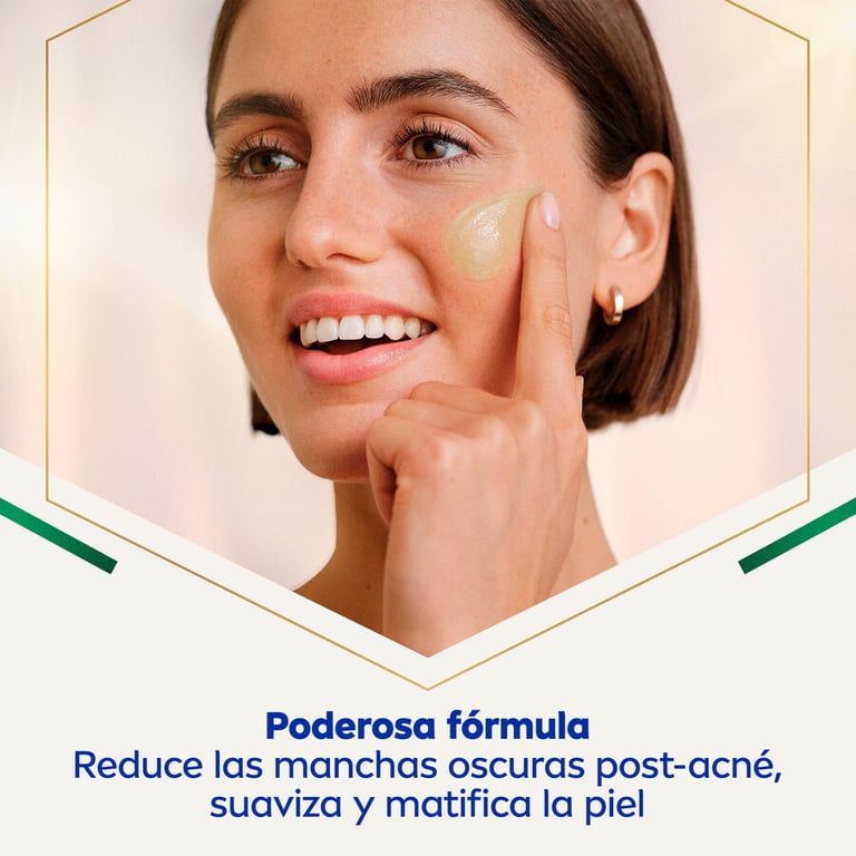 Luminous 630 Serum gegen Post-Akne-Markierungen 30 ml von Nivea