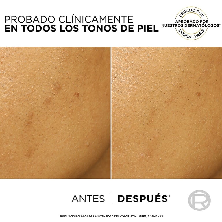 Bright Reveal Peeling Fleckenentfernendes Peeling 25 ml von L'Oreal Paris