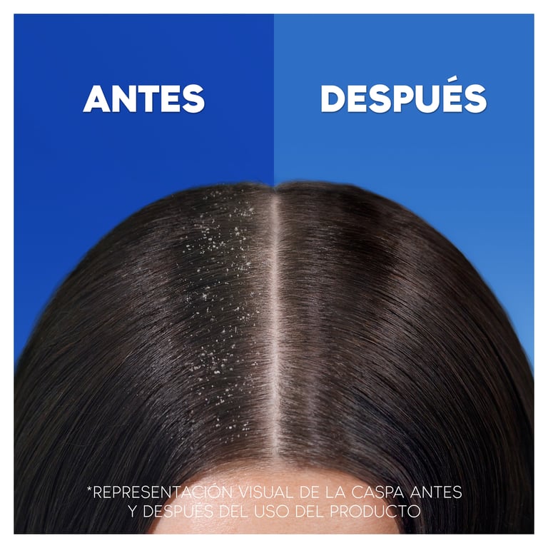 H&S Shampooing Antipelliculaire Nourrit & Prend Soin 300 ml de Head & Shoulders
