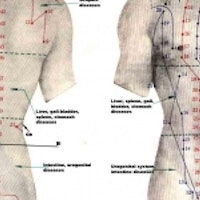 Acupuncture for Chronic Back Pain