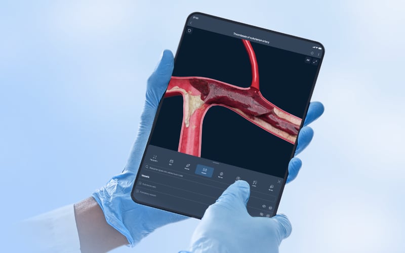 VOKA 3D Anatomy & Pathology screenshot 3