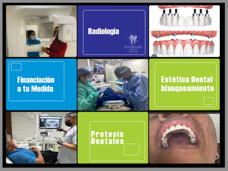 Galeria de tratamientos dentales y resultados