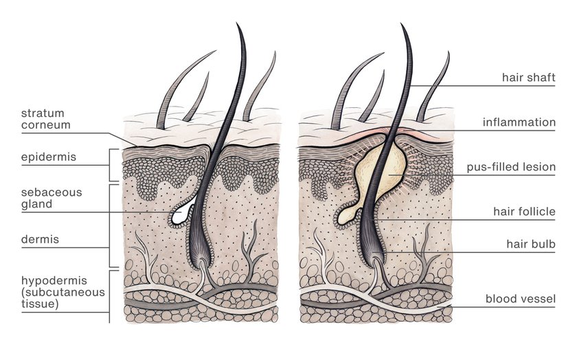 Petra Kneile hair follicle