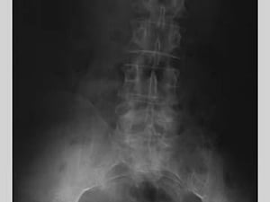 Lower Spine - Art Print