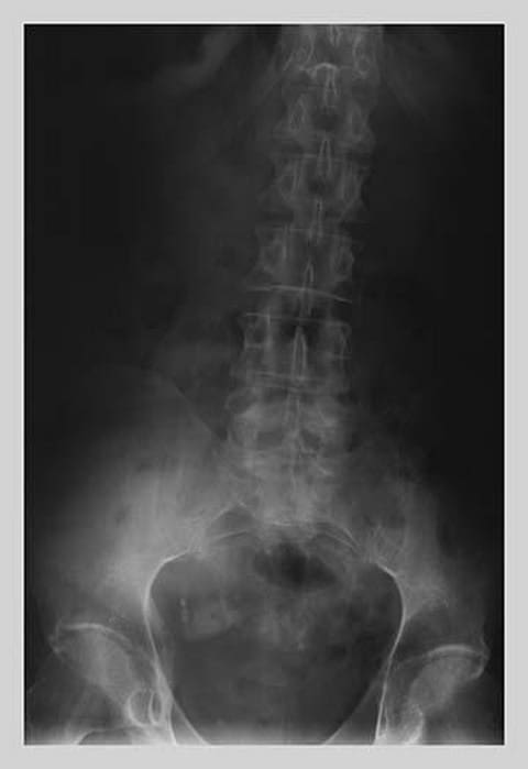 Lower Spine - Art Print