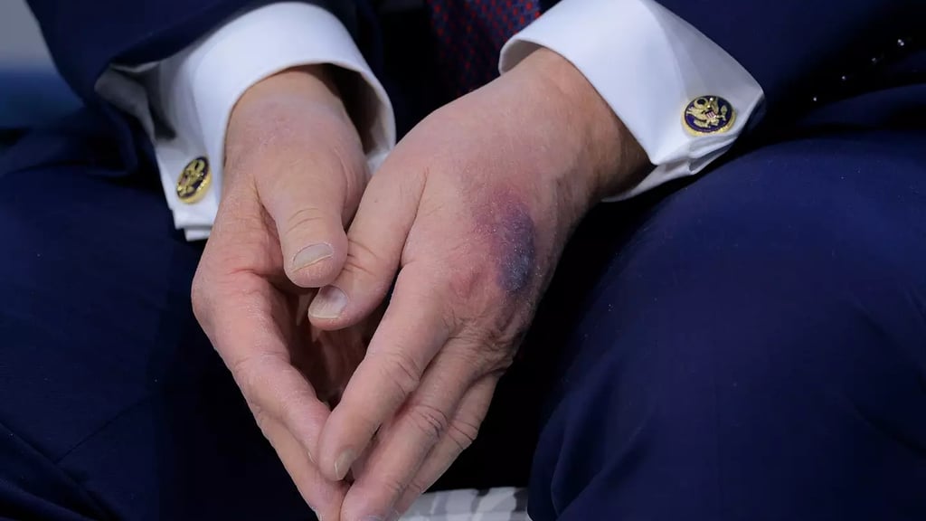 trump_hand_16x9