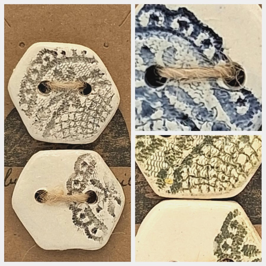 Large Lace Ceramic buttons 