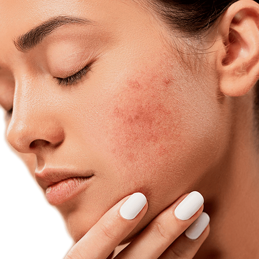 Pigment Control Crème for Hyperpigmentation 5 Understanding Hyperpigmentation: Causes and Effects