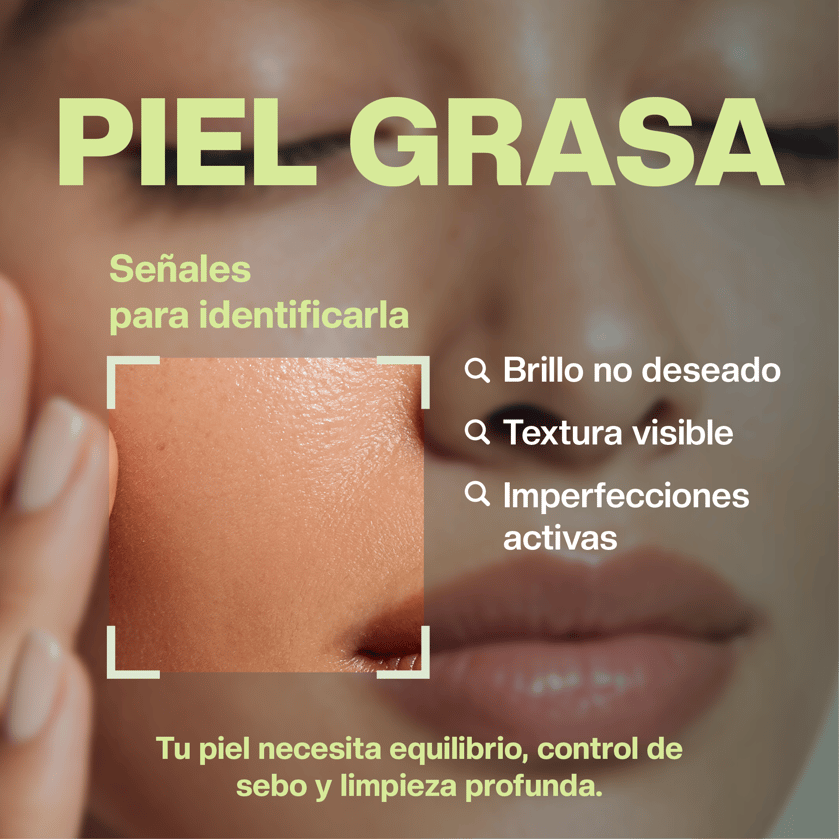 Piel Grasa