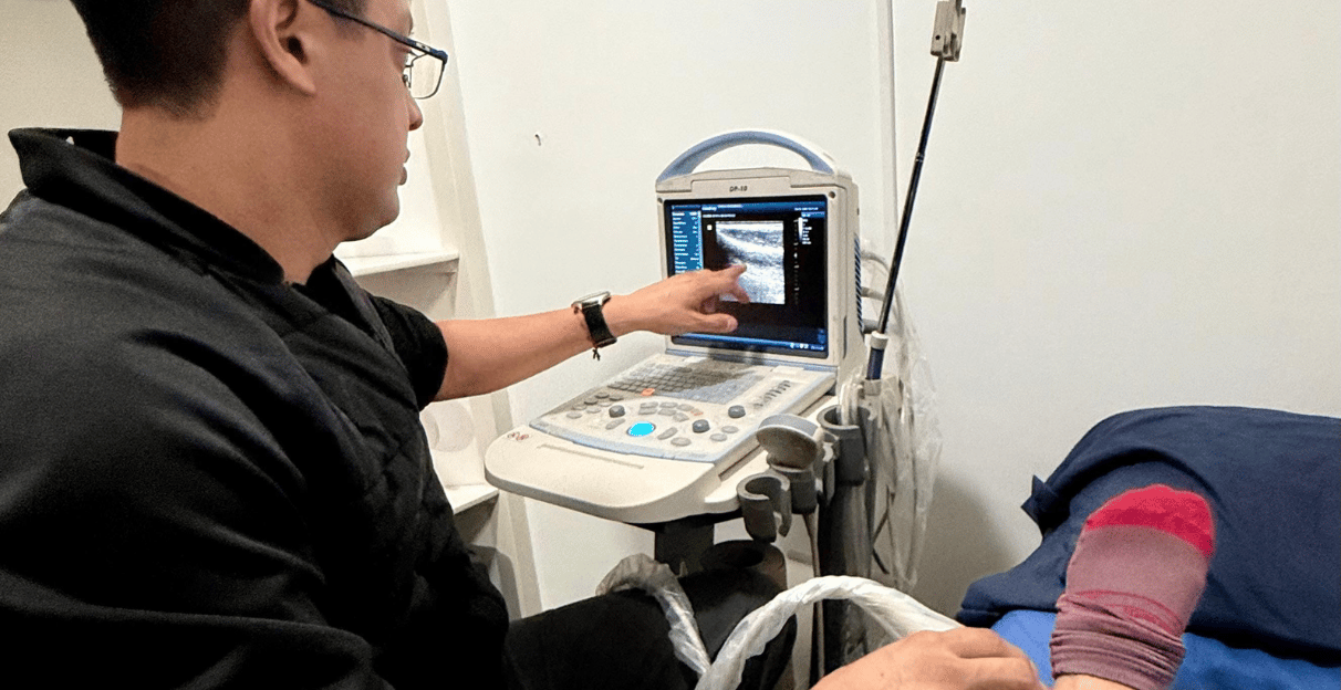 Cómo manejar el impacto mental de una lesión en endurance y volver más fuerte