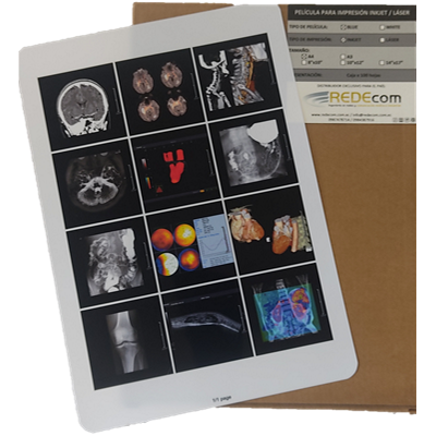 Película Blanca Láser