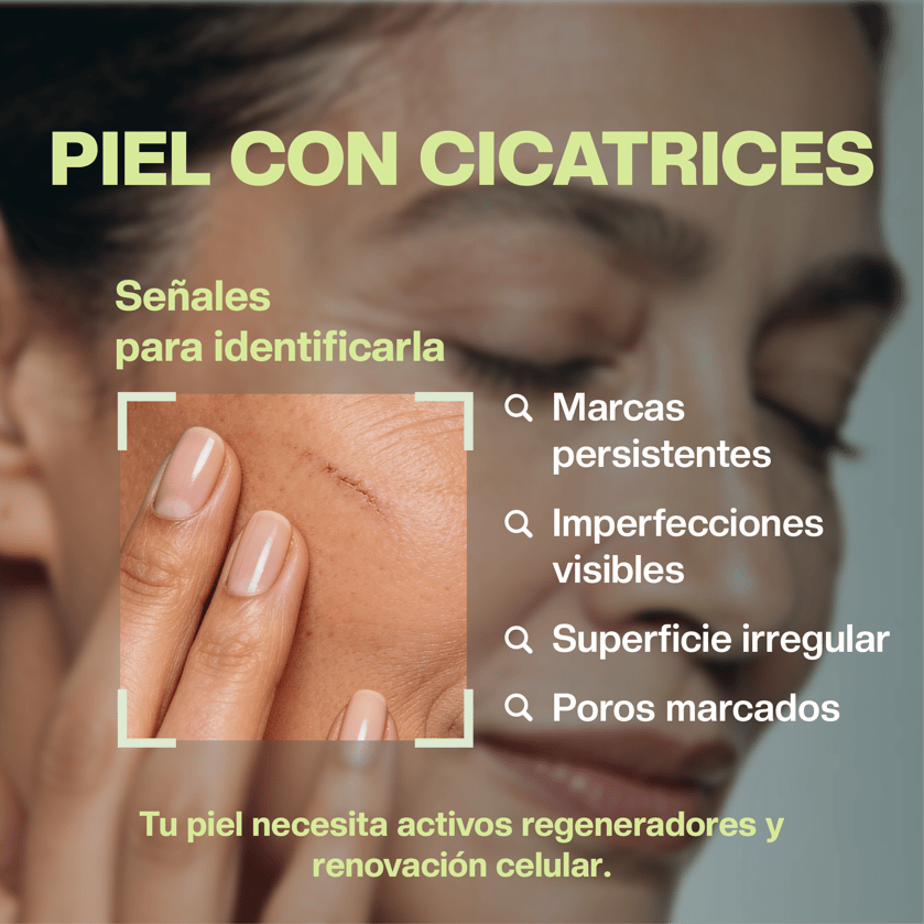 Cicatrices
