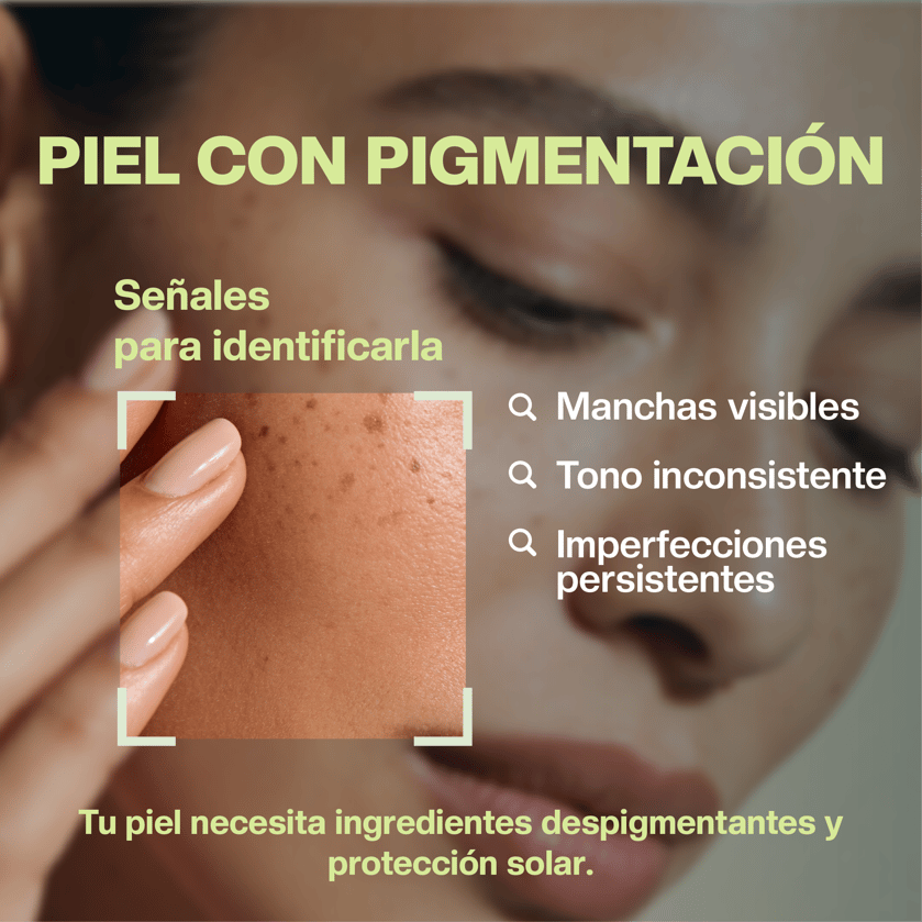 Pigmentación