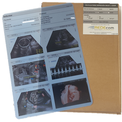 Película Azul Inkjet