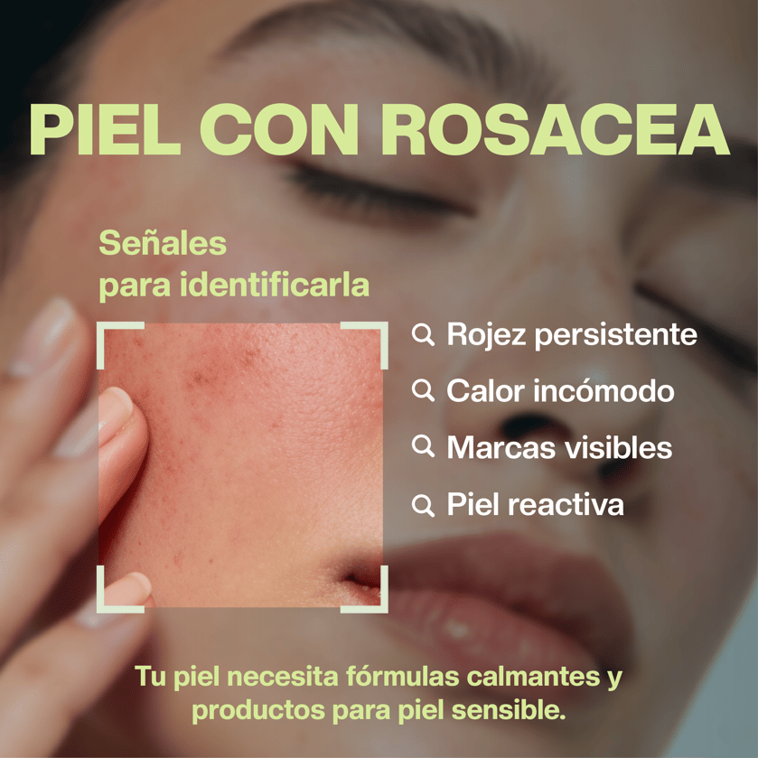 Piel Rosacea
