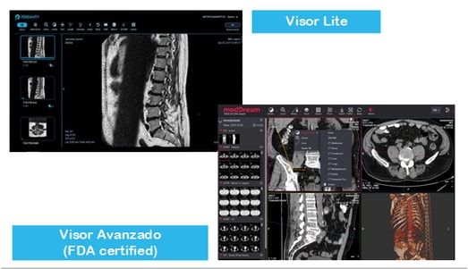 Visor Lite y Visor MedDream (opcional)