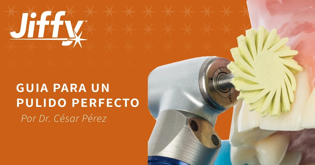 Guía Para un Pulido Perfecto con Jiffy