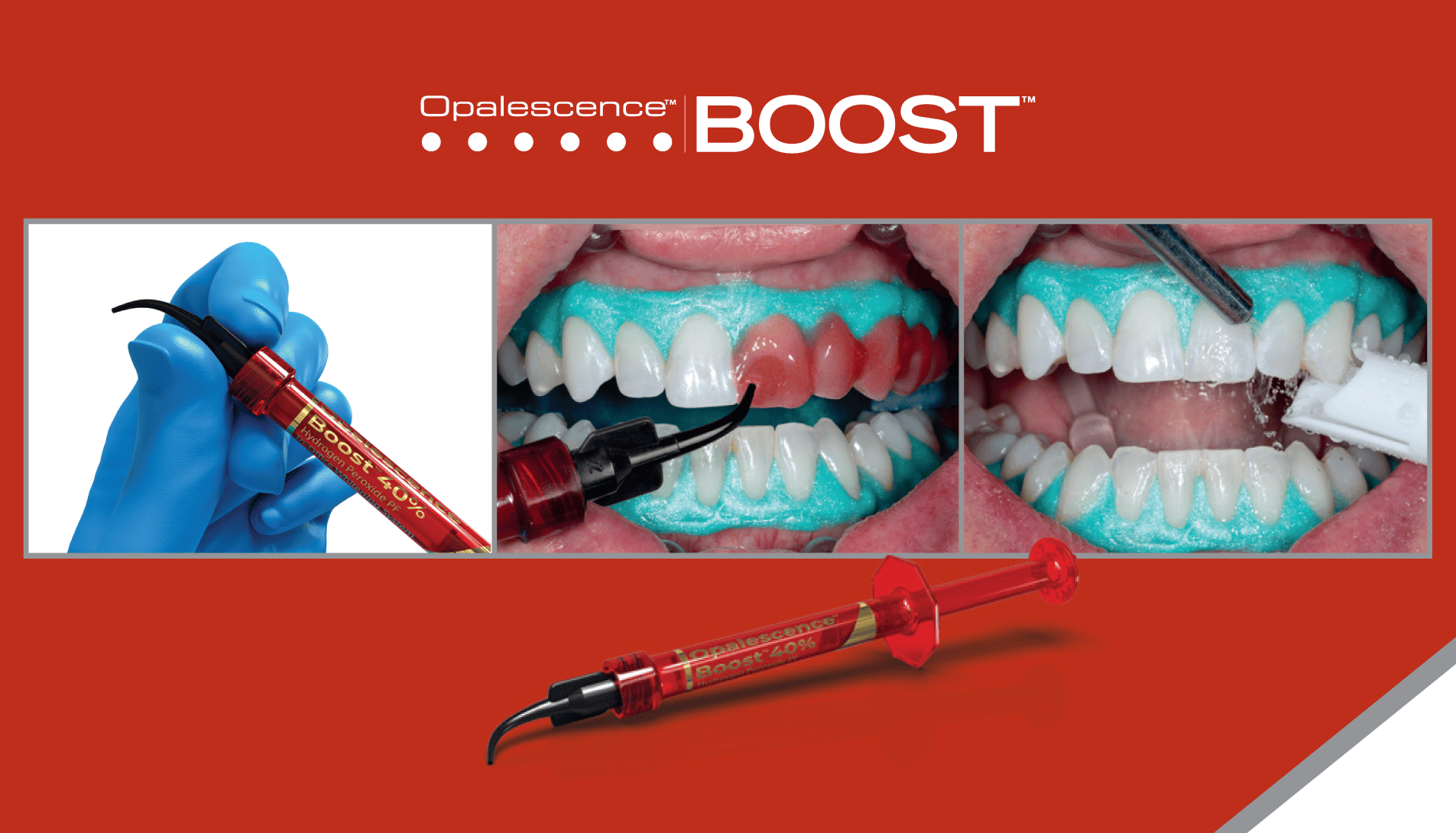 Guia técnica: Manejo adecuado de Opalescence Boost