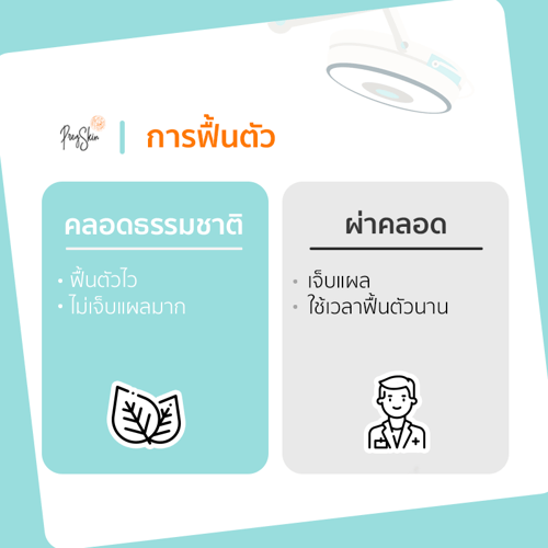 ข้อดี ข้อเสีย คลอดธรรมชาติ vs ผ่าคลอด