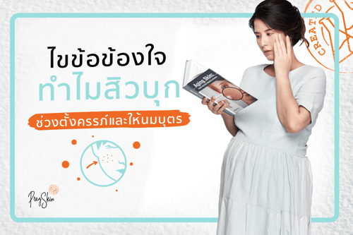 ไขข้อข้องใจทำไมสิวบุกช่วงตั้งครรภ์และให้นมบุตร