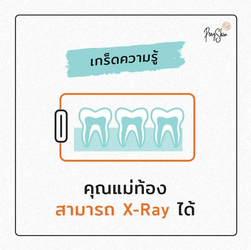 x ray and pregnant women