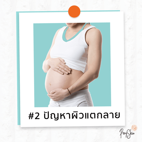 ท้องแตกลายตั้งครรภ์