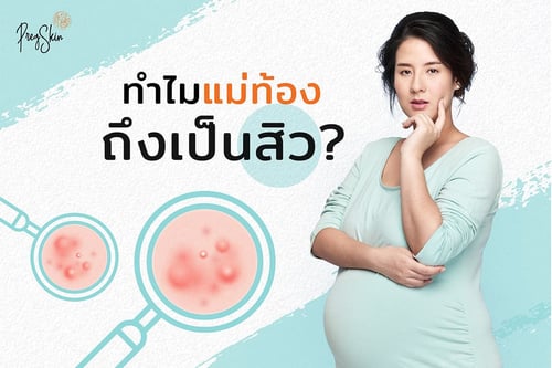 ทำไมแม่ท้องถึงเป็นสิว?