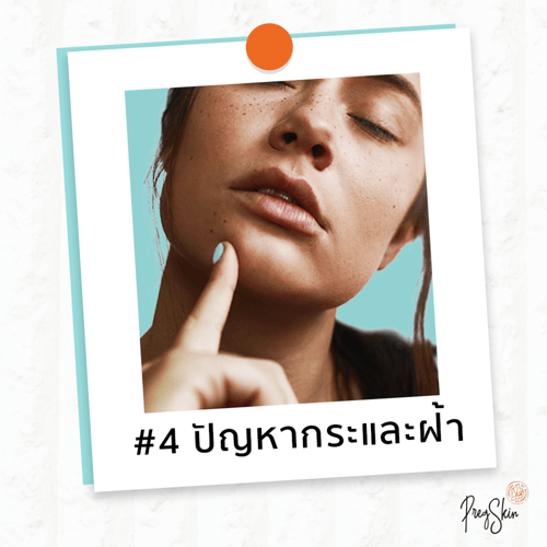 ครีมคนท้อง