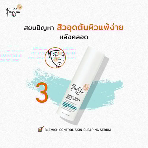 สยบปัญหา สิวอุดตันผิวแพ้ง่ายหลังคลอด