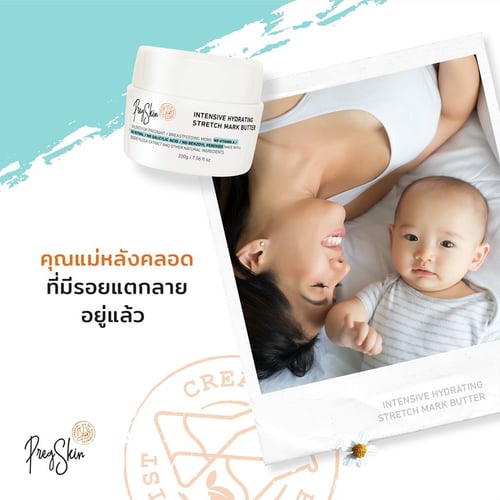 stretch marks prevention cream for pregnant women after delivery