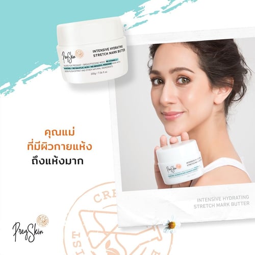 stretch marks prevention cream for women