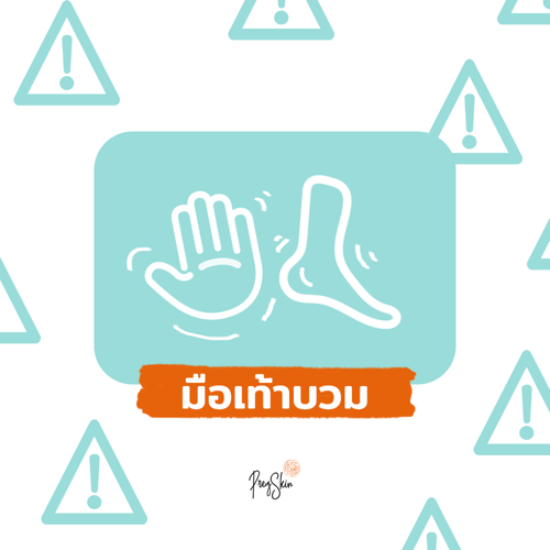 มือเท้าบวม ระหว่างตั้งครรภ์