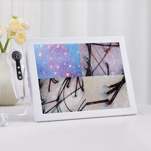 Scalp camera probe being used on a client's hair