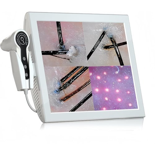 Professional 15-inch scalp camera full setup in salon environment