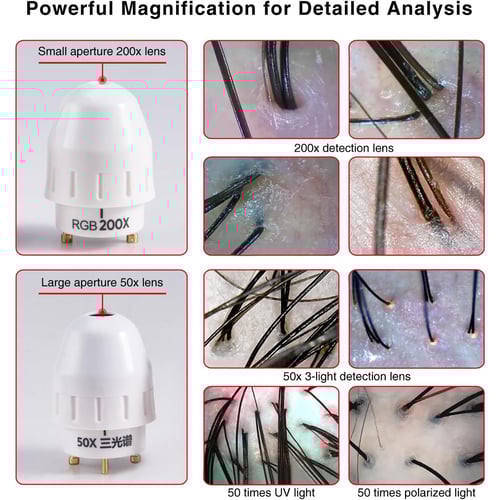 Scalp camera probe and display screen close-up