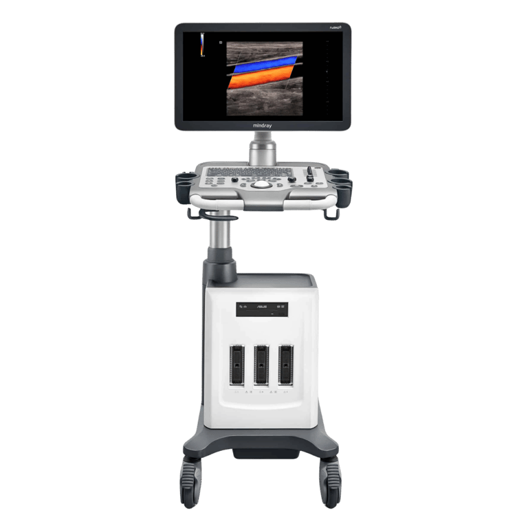 Mindray DC-30 Einstiegs-Ultraschallgerät Allgemeinmedizin