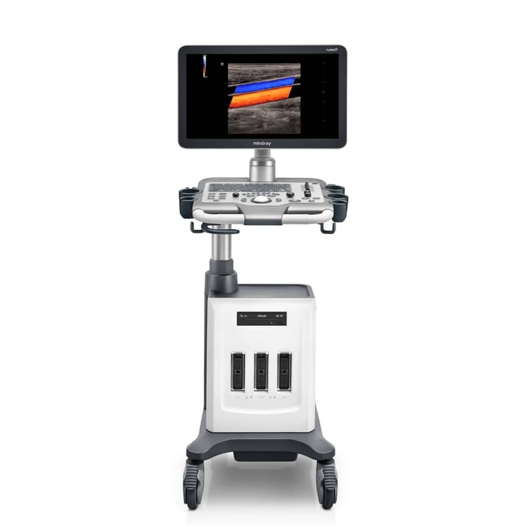 Mindray DC 30 Full HD Frontalansicht mit 21,5-Zoll-Monitor