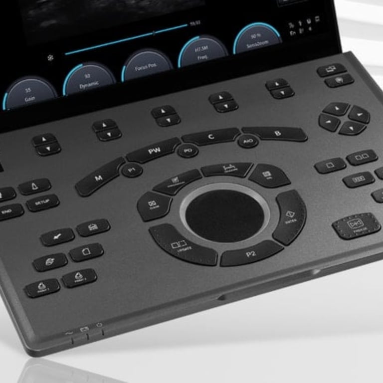 Chison SonoAir 70 Touchscreen-Bedienfeld