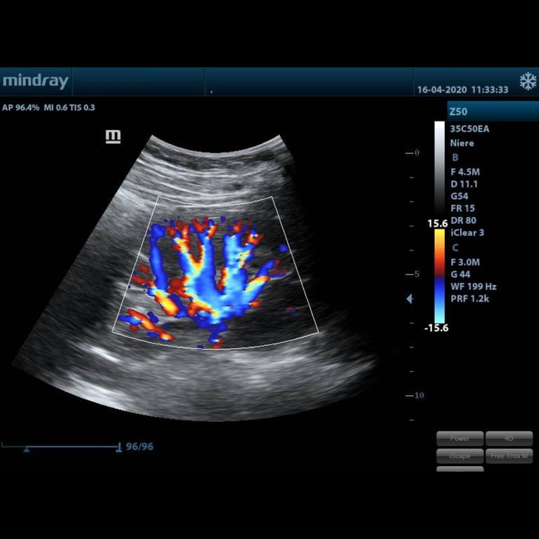 Mindray Z50 Bedienfeld Trackball Funktionstasten