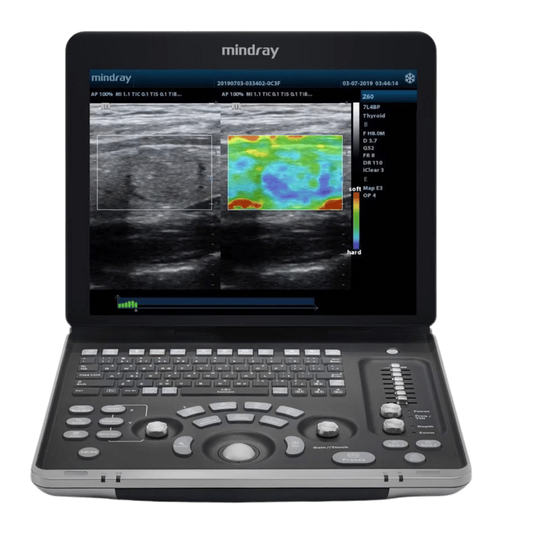 Mindray DP-50 portables Schwarz-Weiß Ultraschallsystem