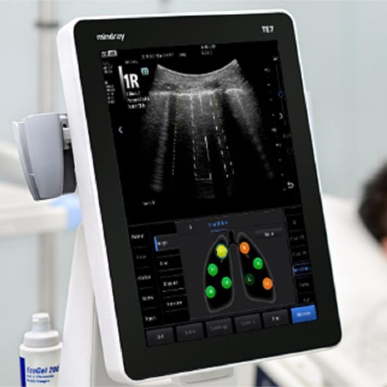 Mindray TE7 ACE eSpacial Navi magnetische Nadelnavigation