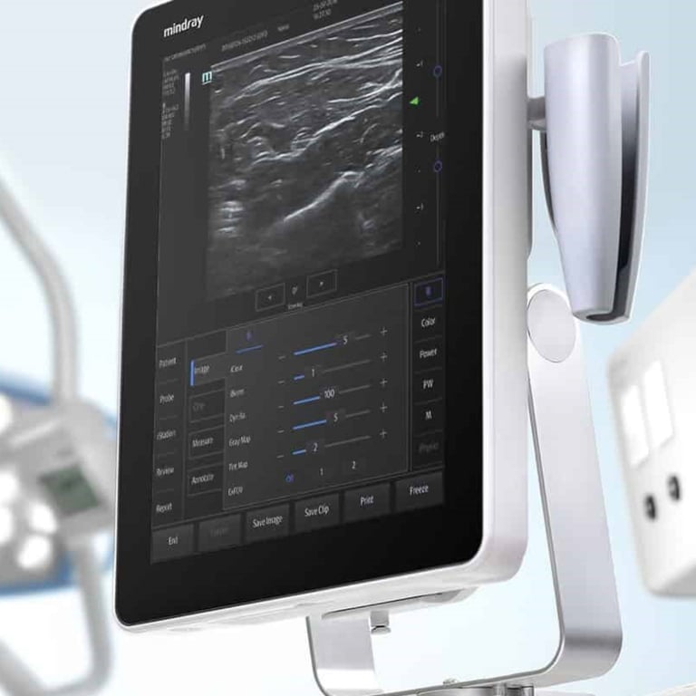 Mindray TE5 Brachialplexus Hochfrequenz-Nervendarstellung