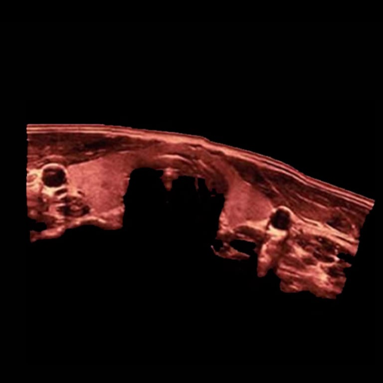 Mindray Z60 Bildbeispiel Abdomen Sonographie