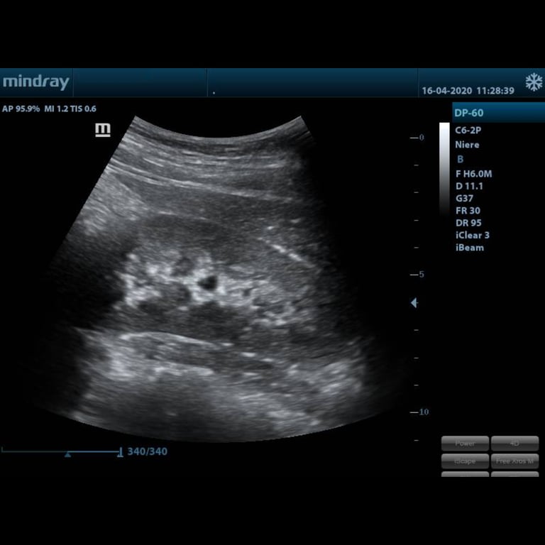 DP-60 Display Ultraschallbild