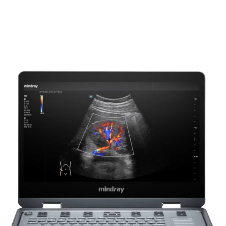 Mindray MX3 im klinischen Einsatz Allgemeinmedizin Hausarztpraxis